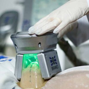 Operador Avanzado en Criolipólisis